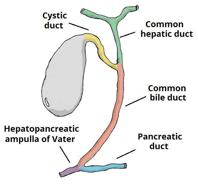 Fig 1 - The biliary tree. A gallstone in the ampulla of Vater is a common cause of acute pancreatitis.