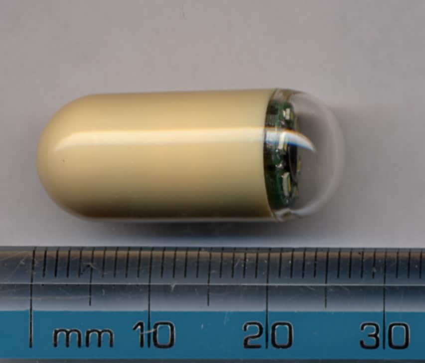 Fig 1 - Capsule endoscopy is the preferred imaging choice for small bowel angiodysplasia.