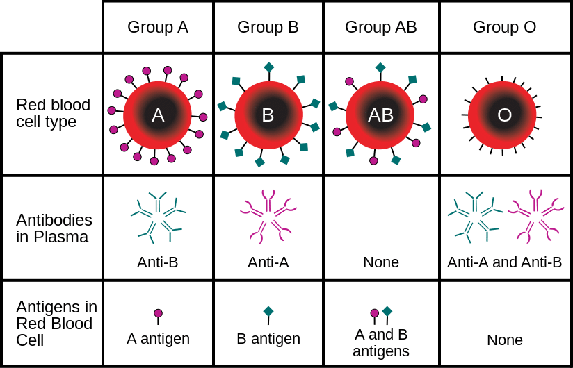 Fig 2 - The ABO blood groups. Giving a patient an incompatible blood product can result in an acute haemolytic reaction.