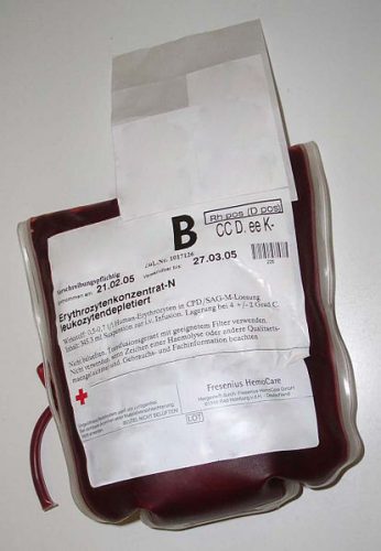 Blood products are required to correct heavy blood loss and must be x-matched before use.