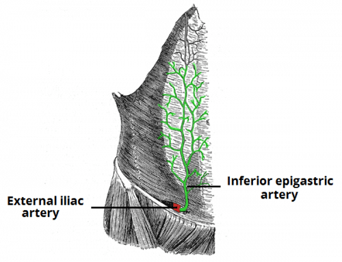 Fig 2 - Anatomical course of the inferior epigastric artery.