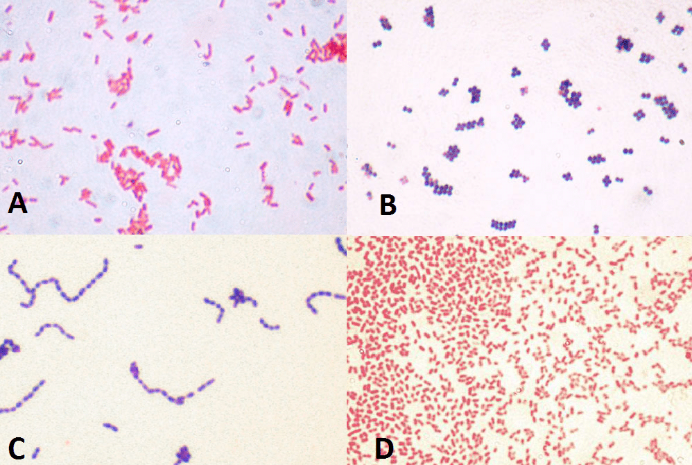 Fig 1 - Common causes of HAP under Gram Stain (A) E. Coli (B) MRSA (C) S. Pneumonia (D) P. Aeuroginosa