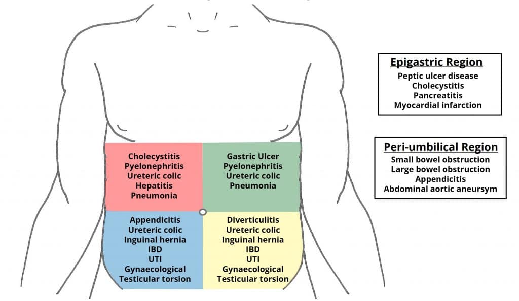 Fig 1 - Differential diagnoses for pain felt in the different regions of the abdomen.
