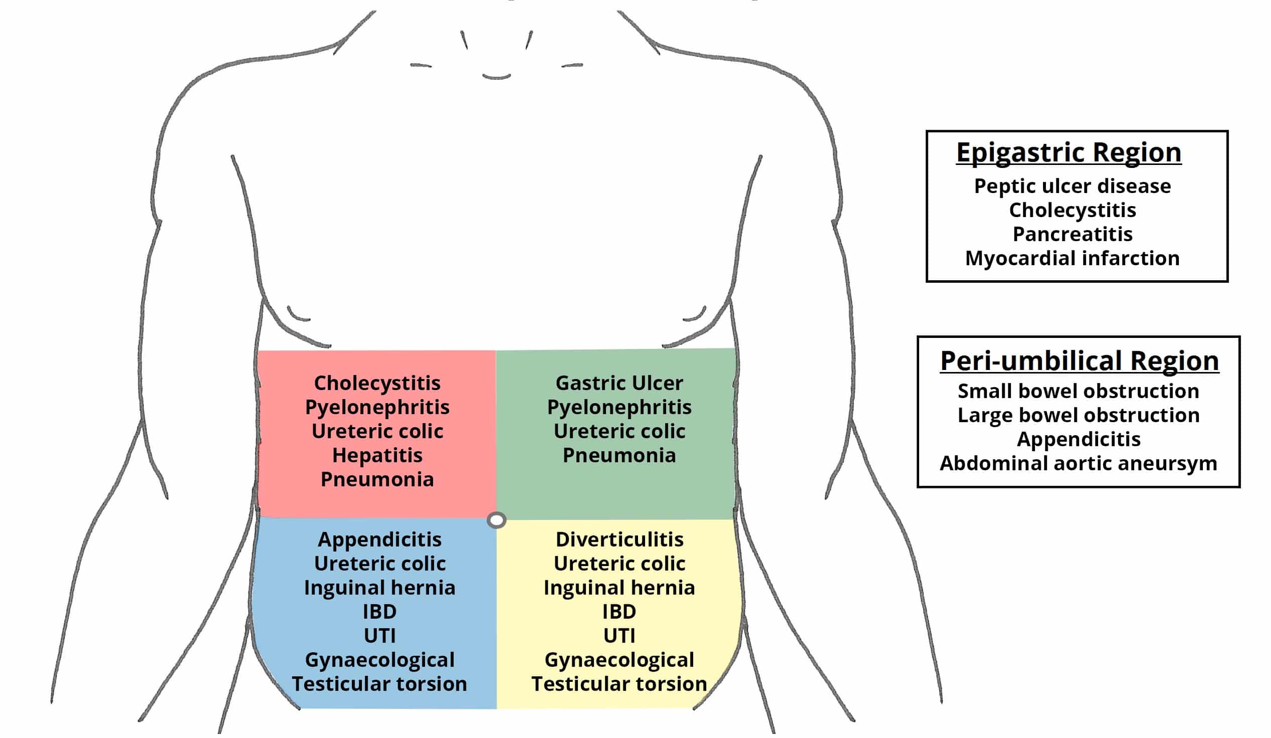 the acute abdomen causes management teachmesurgery