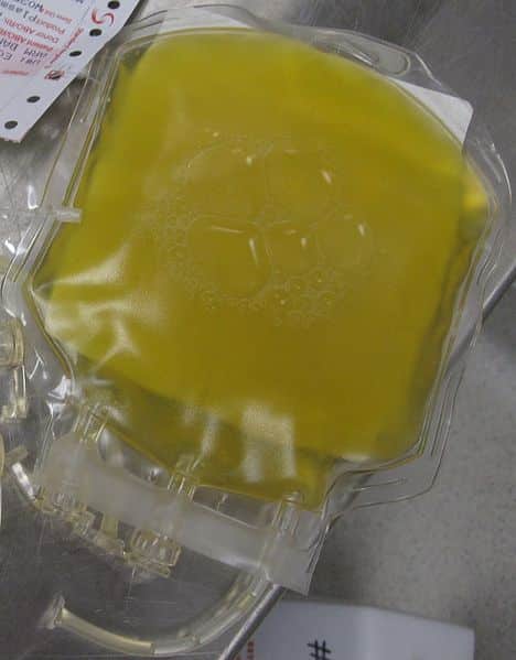 Fig 1 - Consider the use of fresh frozen plasma after 4 units of blood.