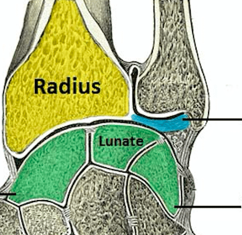 distal radius fracture surgery video