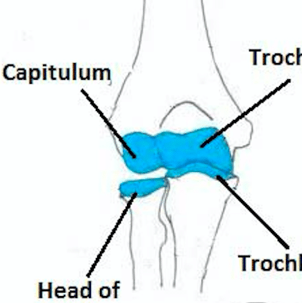 Radial Head Fractures - Clinical Features - Management - TeachMeSurgery