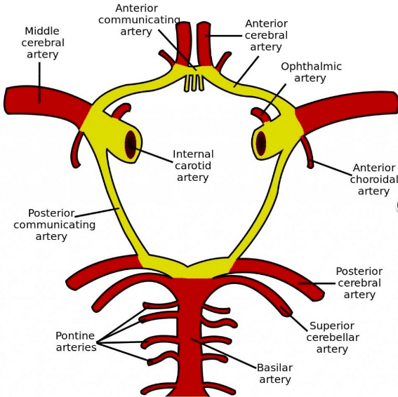 Subarachnoid Hemorrhage (SAH) - Physiopedia