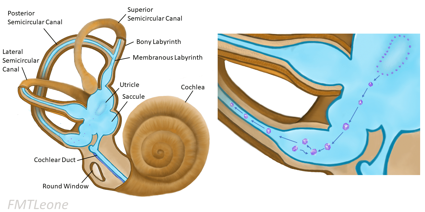 causes of vertigo