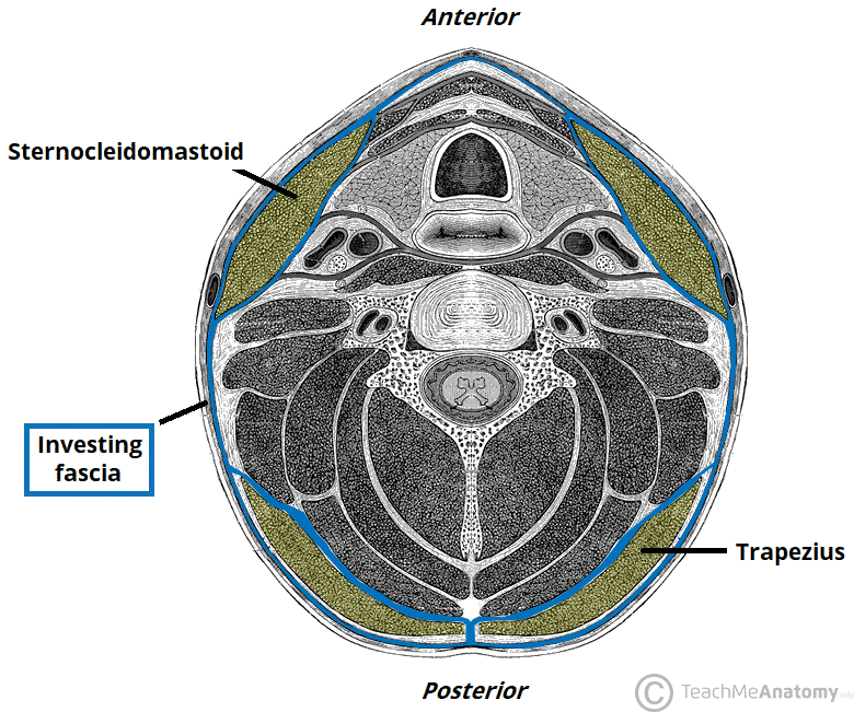 retropharyngeal abscess diagram