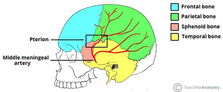 Subarachnoid hemorrhage - Wikipedia